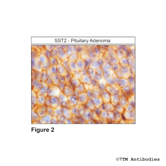 SST2, Somatostatin Receptor 2 Antibody in Immunohistochemistry (Paraffin) (IHC (P))