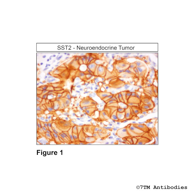 SST2, Somatostatin Receptor 2 Antibody in Immunohistochemistry (Paraffin) (IHC (P))