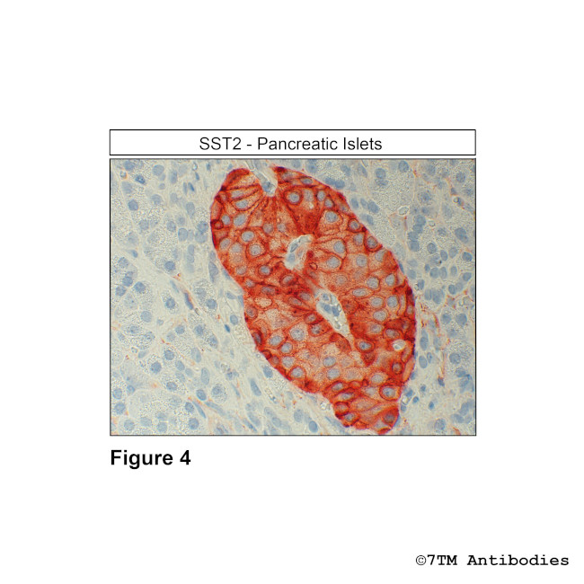 SST2, Somatostatin Receptor 2 Antibody in Immunohistochemistry (Paraffin) (IHC (P))