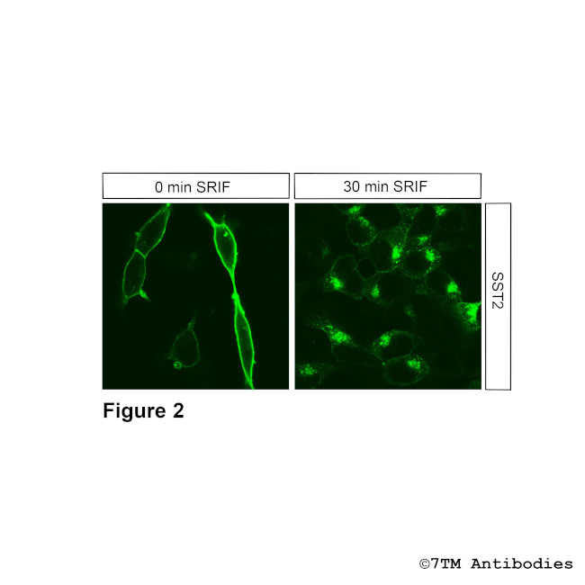 SST2, Somatostatin Receptor 2 Antibody in Immunocytochemistry (ICC/IF)