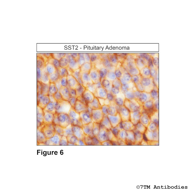 SST2, Somatostatin Receptor 2 Antibody in Immunohistochemistry (PFA fixed) (IHC (PFA))