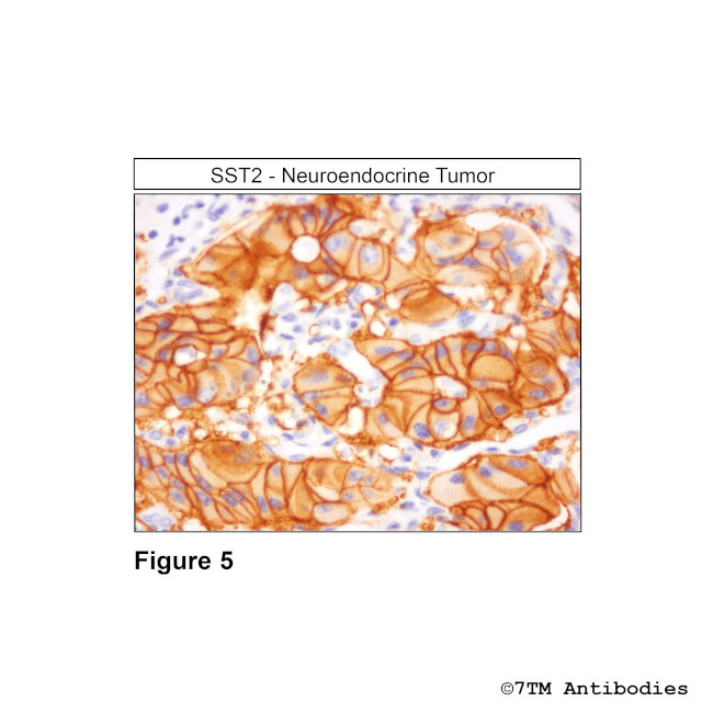 SST2, Somatostatin Receptor 2 Antibody in Immunohistochemistry (PFA fixed) (IHC (PFA))