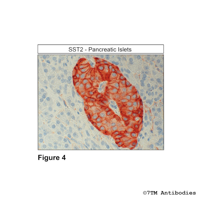 SST2, Somatostatin Receptor 2 Antibody in Immunohistochemistry (PFA fixed) (IHC (PFA))