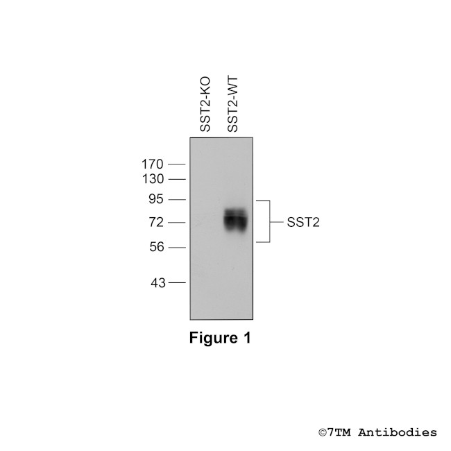 SST2, Somatostatin Receptor 2 Antibody in Western Blot (WB)