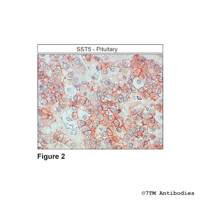 SST5, Somatostatin Receptor 5 Antibody in Immunohistochemistry (Paraffin) (IHC (P))