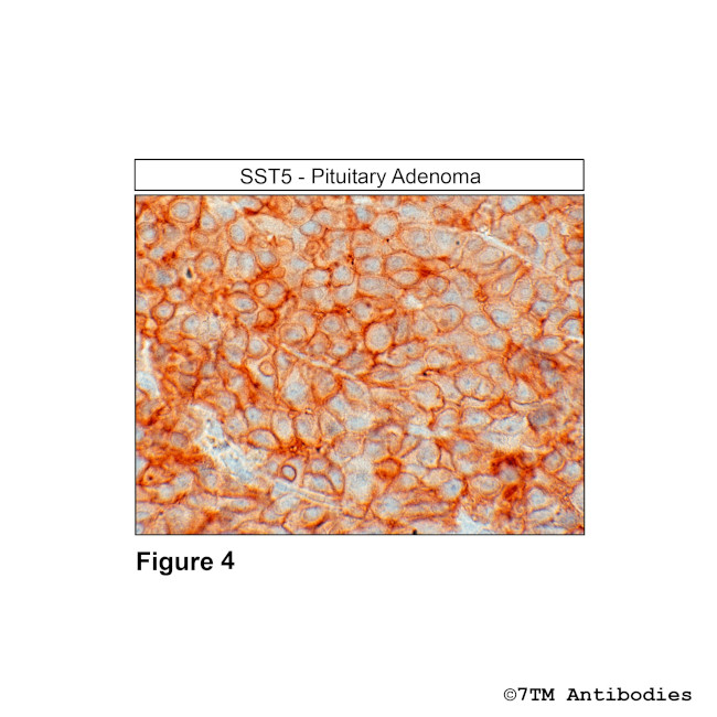 SST5, Somatostatin Receptor 5 Antibody in Immunohistochemistry (Paraffin) (IHC (P))