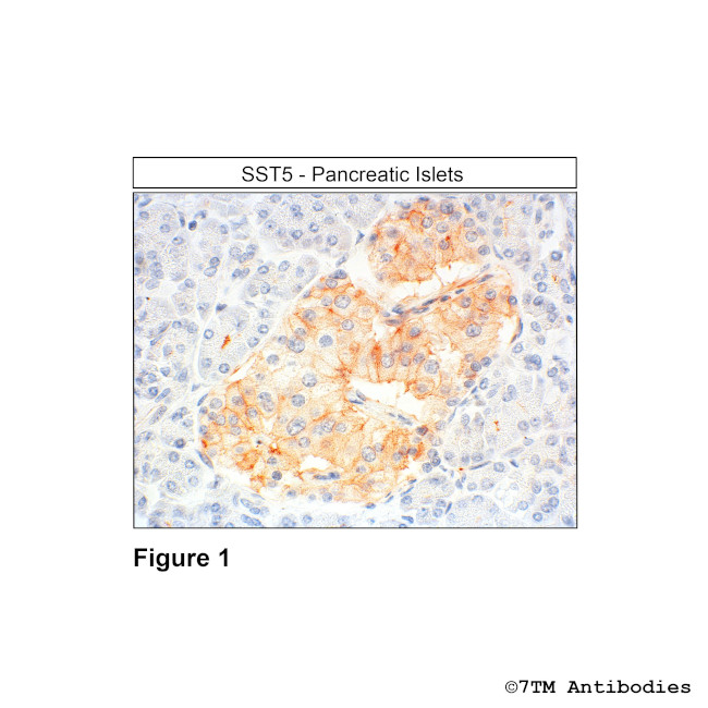 SST5, Somatostatin Receptor 5 Antibody in Immunohistochemistry (Paraffin) (IHC (P))