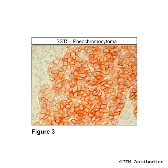 SST5, Somatostatin Receptor 5 Antibody in Immunohistochemistry (Paraffin) (IHC (P))