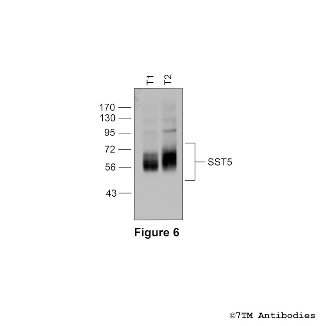 SST5, Somatostatin Receptor 5 Antibody in Western Blot (WB)