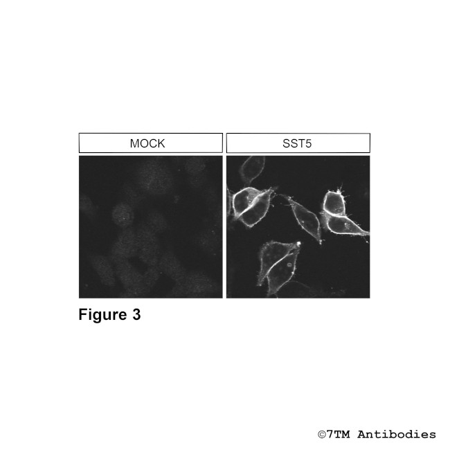 SST5, Somatostatin Receptor 5 Antibody in Immunocytochemistry (ICC/IF)