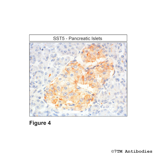 SST5, Somatostatin Receptor 5 Antibody in Immunohistochemistry (PFA fixed) (IHC (PFA))