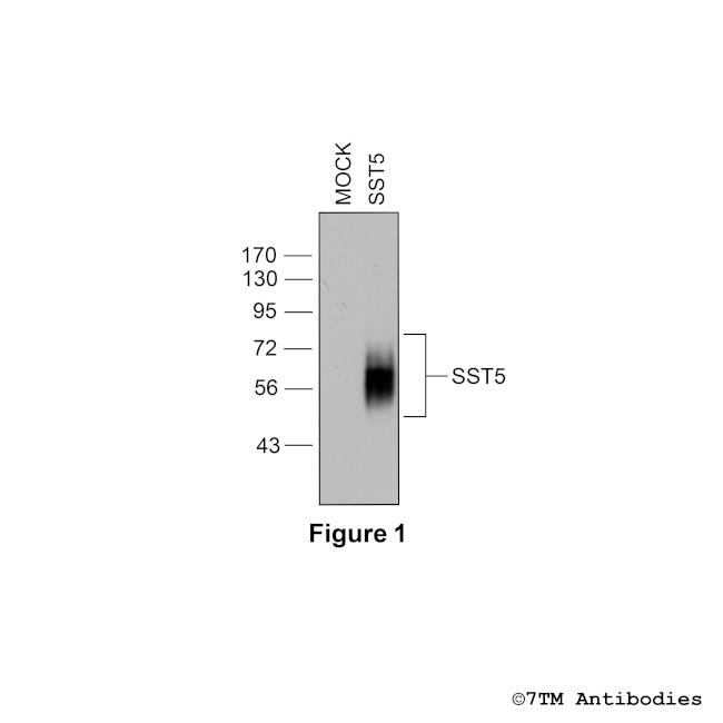 SST5, Somatostatin Receptor 5 Antibody in Western Blot (WB)