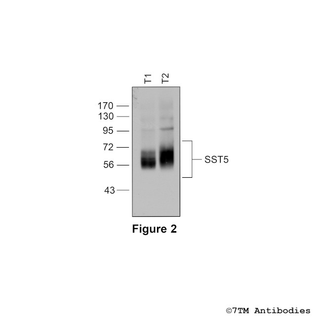 SST5, Somatostatin Receptor 5 Antibody in Western Blot (WB)