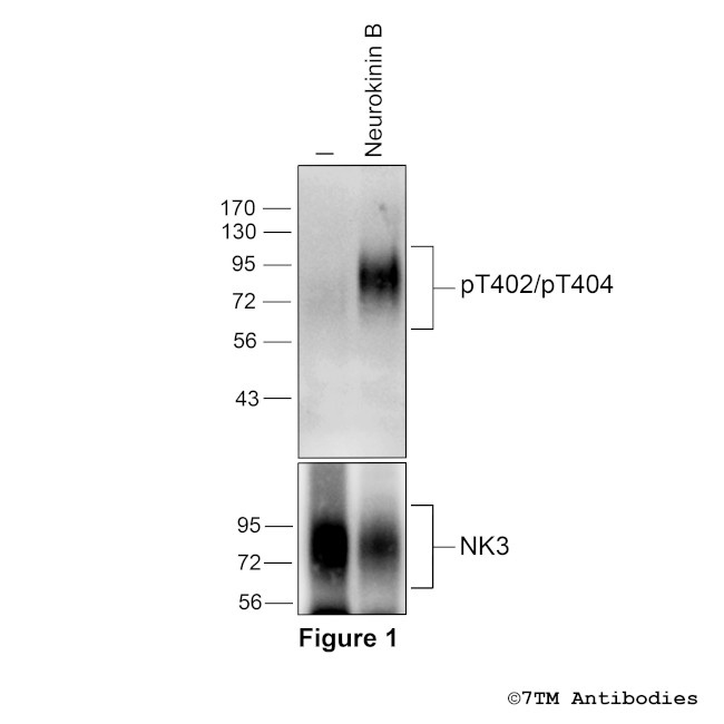 Phospho-Tachykinin Receptor 3 (Thr402, Thr404) Antibody in Western Blot (WB)