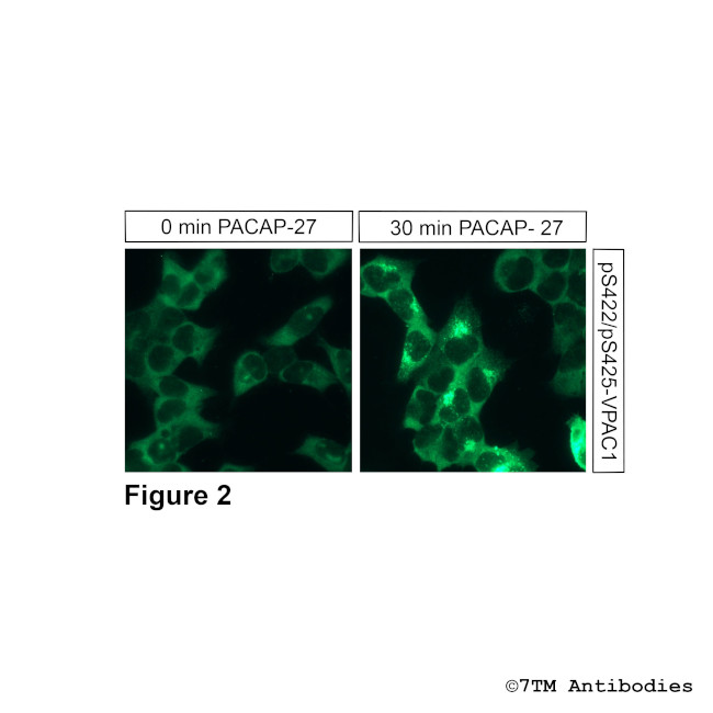 Phospho-VIP Receptor 1 (Ser422, Ser425) Antibody in Immunocytochemistry (ICC/IF)