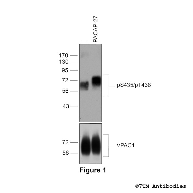 Phospho-VIP Receptor 1 (Ser435, Thr438) Antibody in Western Blot (WB)