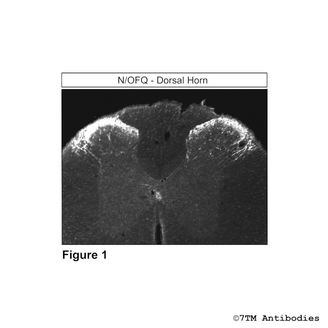 N/OFQ, Nociceptin/Orphanin FQ Antibody in Immunohistochemistry (Paraffin) (IHC (P))