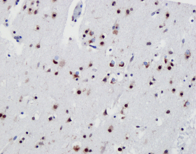 TDP-43 Antibody in Immunohistochemistry (IHC)