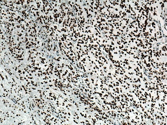 TDP-43 Antibody in Immunohistochemistry (Paraffin) (IHC (P))