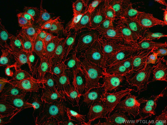 TDP-43 Antibody in Immunocytochemistry (ICC/IF)