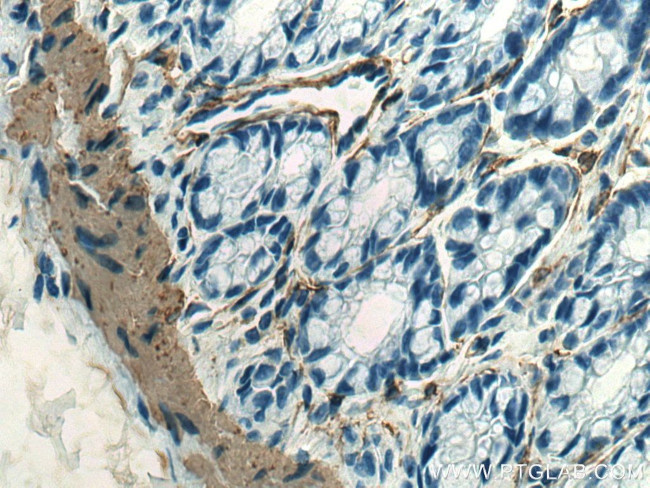 smooth muscle actin Antibody in Immunohistochemistry (Paraffin) (IHC (P))