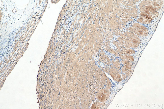 smooth muscle actin Antibody in Immunohistochemistry (Paraffin) (IHC (P))