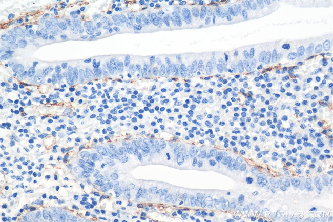 smooth muscle actin Antibody in Immunohistochemistry (Paraffin) (IHC (P))