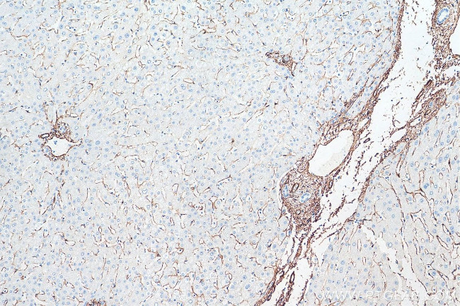 smooth muscle actin Antibody in Immunohistochemistry (Paraffin) (IHC (P))