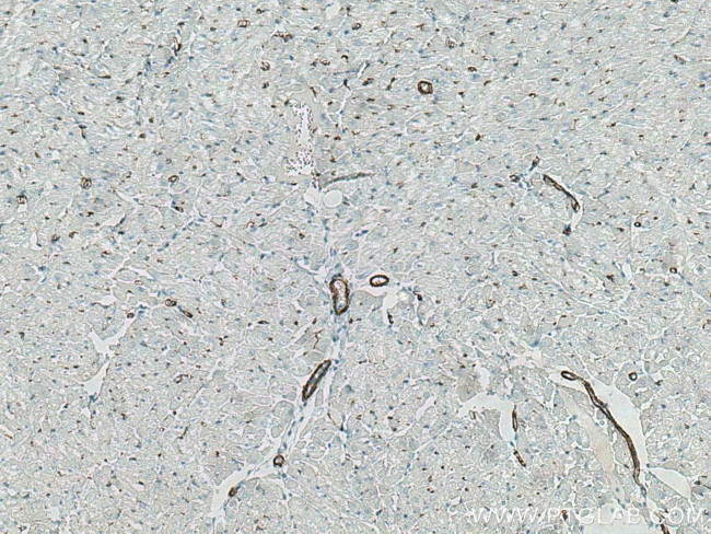 smooth muscle actin Antibody in Immunohistochemistry (Paraffin) (IHC (P))