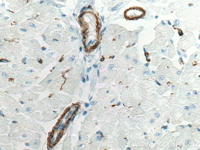 smooth muscle actin Antibody in Immunohistochemistry (Paraffin) (IHC (P))