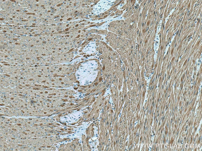 smooth muscle actin Antibody in Immunohistochemistry (Paraffin) (IHC (P))