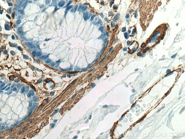 smooth muscle actin Antibody in Immunohistochemistry (Paraffin) (IHC (P))