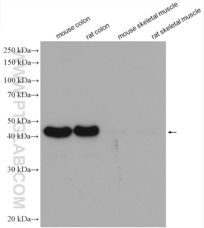 smooth muscle actin Antibody in Western Blot (WB)