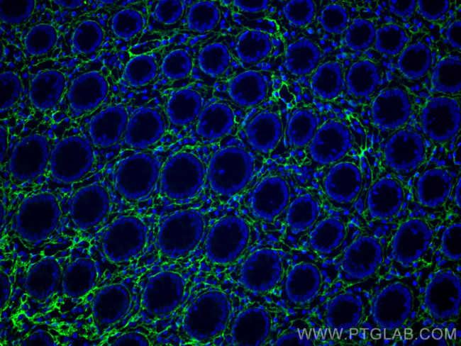 Collagen Type III Antibody in Immunohistochemistry (Paraffin) (IHC (P))