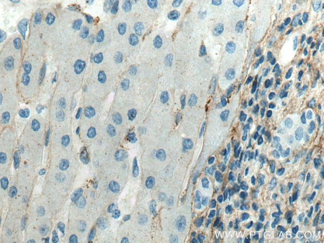 Collagen Type III Antibody in Immunohistochemistry (Paraffin) (IHC (P))