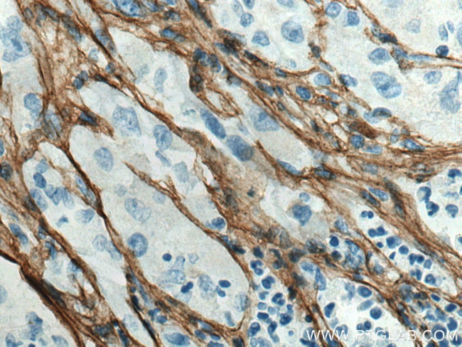 Collagen Type III Antibody in Immunohistochemistry (Paraffin) (IHC (P))