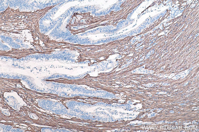 Collagen Type III Antibody in Immunohistochemistry (Paraffin) (IHC (P))