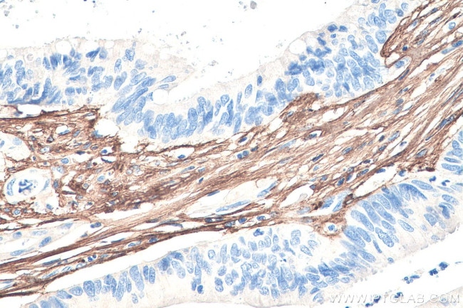 Collagen Type III Antibody in Immunohistochemistry (Paraffin) (IHC (P))