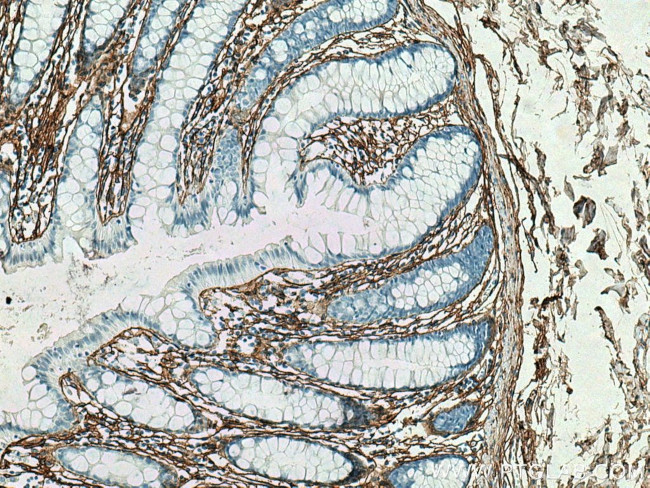 Collagen Type III Antibody in Immunohistochemistry (Paraffin) (IHC (P))