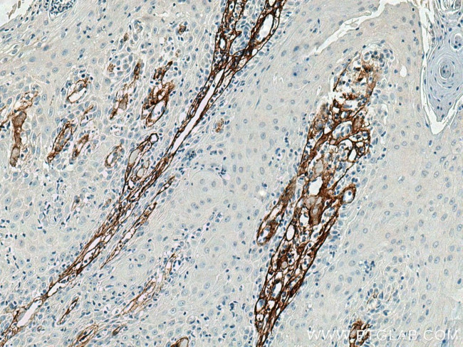 Collagen Type III Antibody in Immunohistochemistry (Paraffin) (IHC (P))