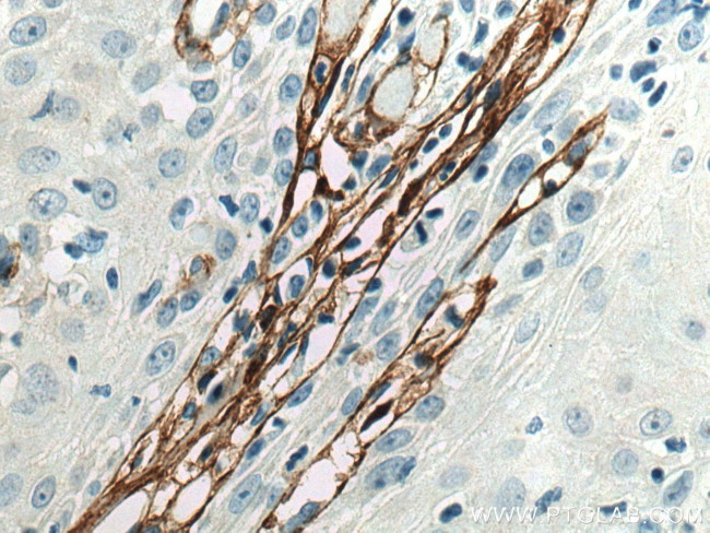 Collagen Type III Antibody in Immunohistochemistry (Paraffin) (IHC (P))