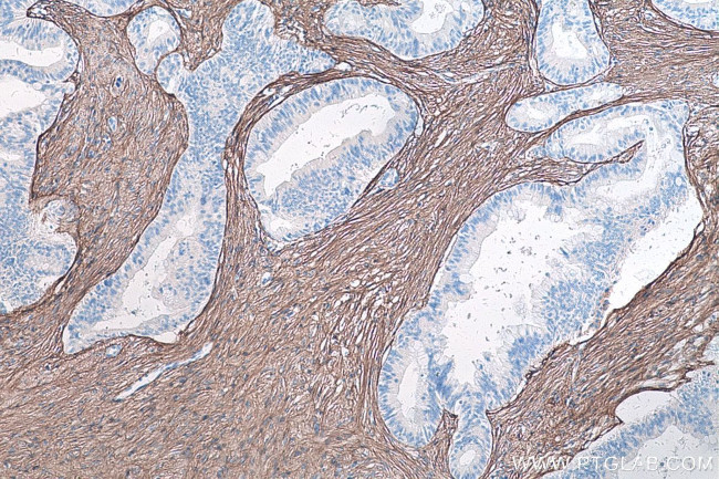 Collagen Type III Antibody in Immunohistochemistry (Paraffin) (IHC (P))