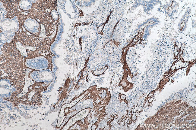 Collagen Type III Antibody in Immunohistochemistry (Paraffin) (IHC (P))