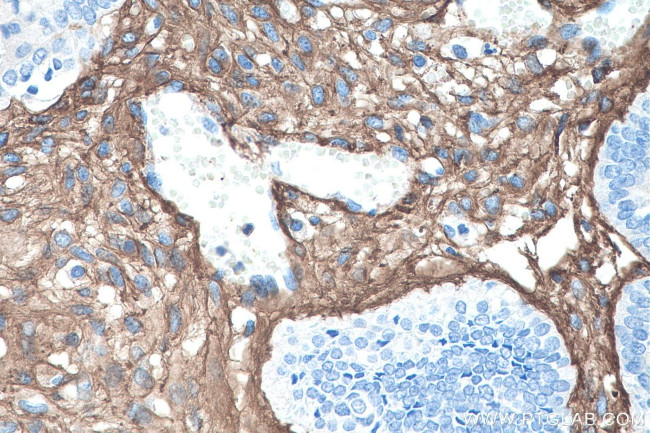 Collagen Type III Antibody in Immunohistochemistry (Paraffin) (IHC (P))