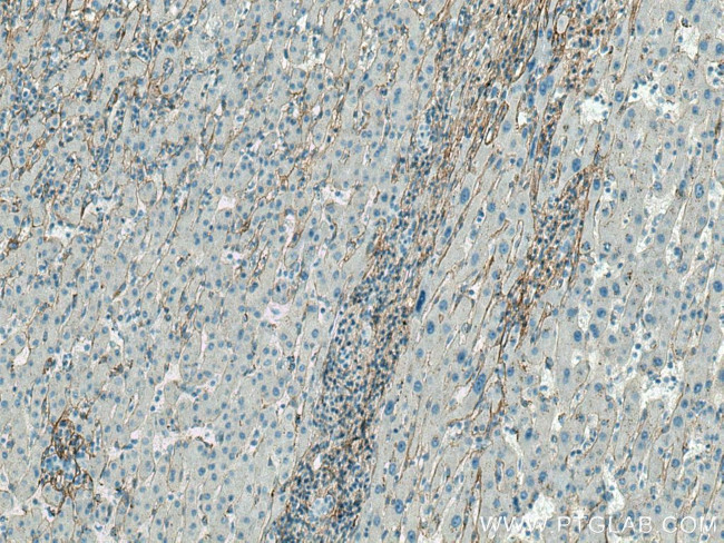 Collagen Type III Antibody in Immunohistochemistry (Paraffin) (IHC (P))