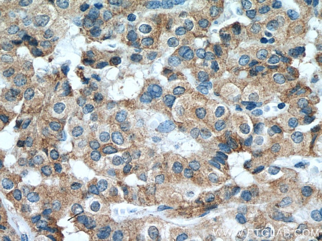 calreticulin Antibody in Immunohistochemistry (Paraffin) (IHC (P))