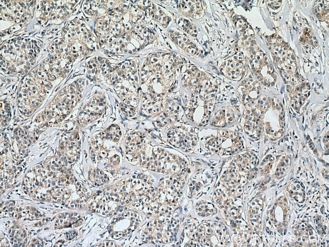 calreticulin Antibody in Immunohistochemistry (Paraffin) (IHC (P))