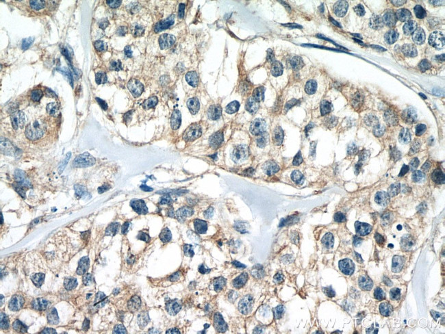 calreticulin Antibody in Immunohistochemistry (Paraffin) (IHC (P))