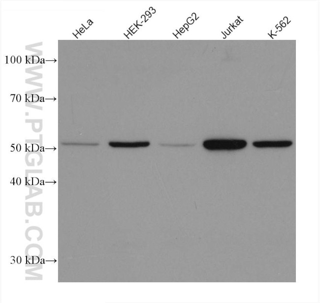 calreticulin Antibody in Western Blot (WB)