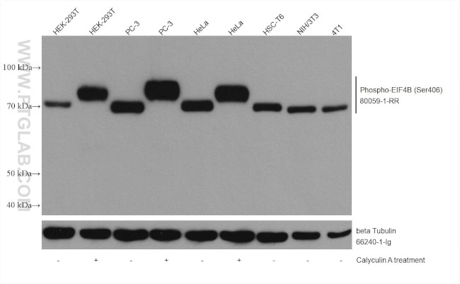 Phospho-EIF4B (Ser406) Antibody in Western Blot (WB)